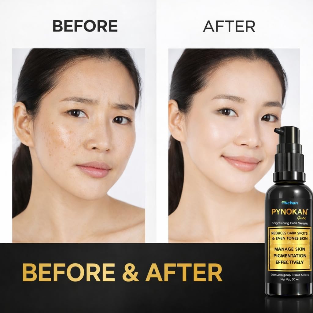 Pynokan Gold Brightening Face Serum, Reduces Pigmentation and Dark